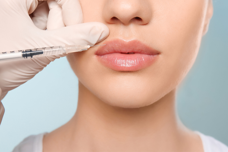 Close-up of a woman's lips as a medical professional prepares to administer a lip filler injection using a syringe, emphasizing precision and care.